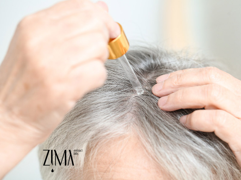 ریزش مو در زنان مسن